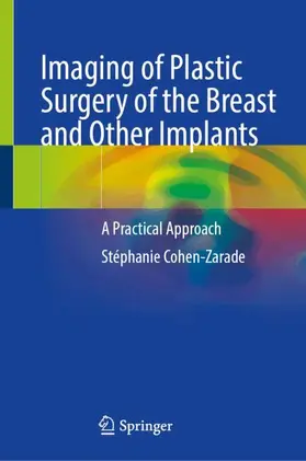 Imaging of Plastic Surgery of the Breast and Other Implants