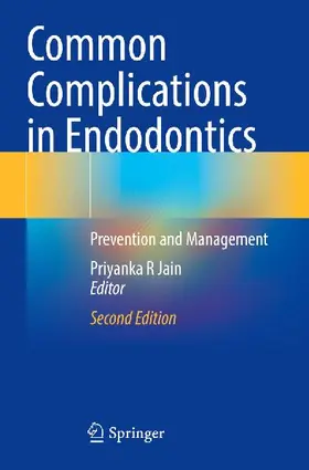 Common Complications in Endodontics