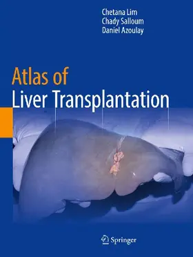 Atlas of Liver Transplantation