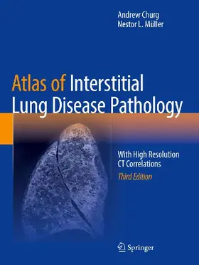 Atlas of Interstitial Lung Disease Pathology