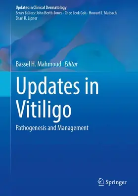 Updates in Vitiligo