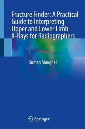 Fracture Finder: A Practical Guide to Interpreting Upper and Lower Limb X-Rays for Radiographers