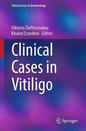 Clinical Cases in Vitiligo