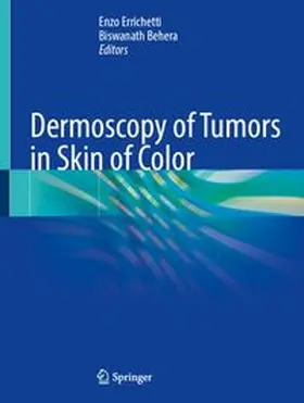 Dermoscopy of Tumors in Skin of Color