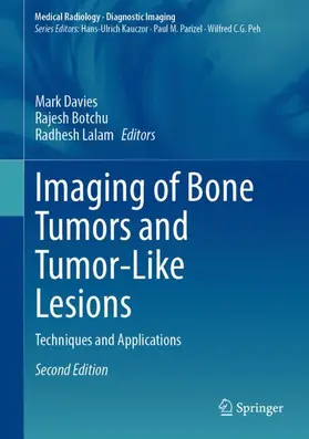 Imaging of Bone Tumors and Tumor-Like Lesions