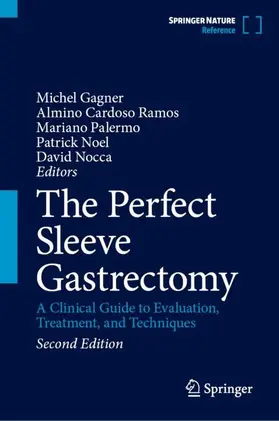 The Perfect Sleeve Gastrectomy