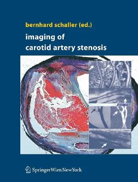 Imaging of Carotid Artery Stenosis