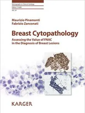 Breast Cytopathology
