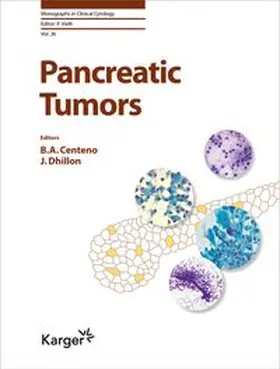 Pancreatic Tumors