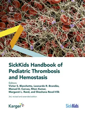 SickKids Handbook of Pediatric Thrombosis and Hemostasis