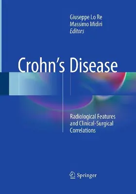 Crohn's Disease