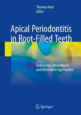 Apical Periodontitis in Root-Filled Teeth