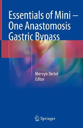 Essentials of Mini ¿ One Anastomosis Gastric Bypass