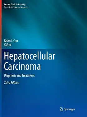 Hepatocellular Carcinoma