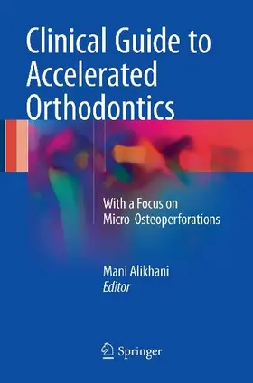 Clinical Guide to Accelerated Orthodontics