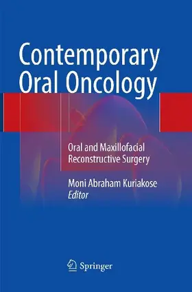 Contemporary Oral Oncology