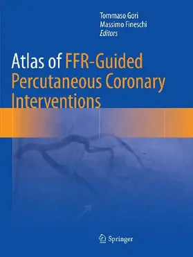 Atlas of FFR-Guided Percutaneous Coronary Interventions
