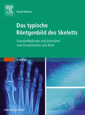 Das typische Röntgenbild des Skeletts
