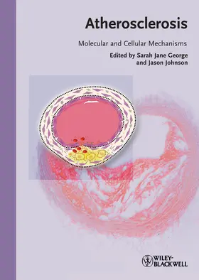 Atherosclerosis