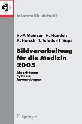 Bildverarbeitung für die Medizin 2005