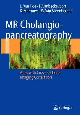 MR Cholangiopancreatography