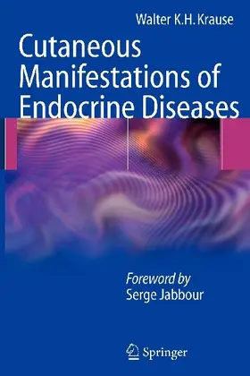 Cutaneous Manifestations of Endocrine Diseases