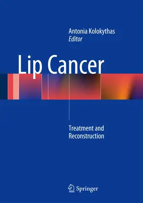 Lip Cancer