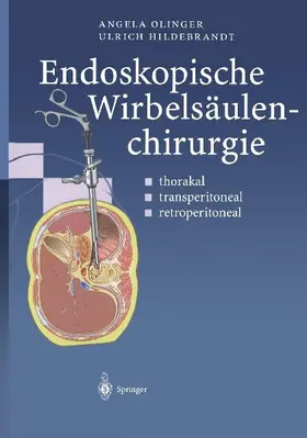 Endoskopische Wirbelsäulenchirurgie