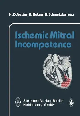 Ischemic Mitral Incompetence