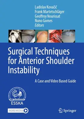Surgical Techniques for Anterior Shoulder Instability