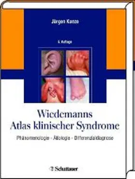 Wiedemanns Atlas klinischer Syndrome