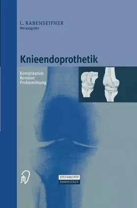 Knieendoprothetik