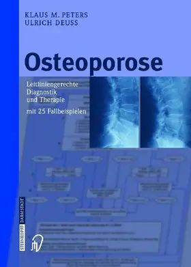 Osteoporose
