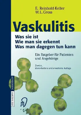Vaskulitis