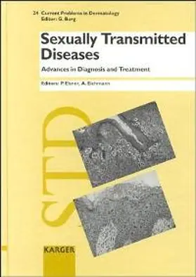 Sexually Transmitted Diseases: Advances in Diagnosis and Treatment