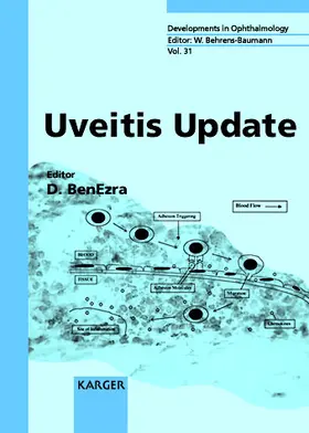 Uveitis Update