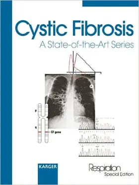 Cystic Fibrosis