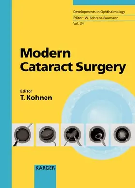 Modern Cataract Surgery
