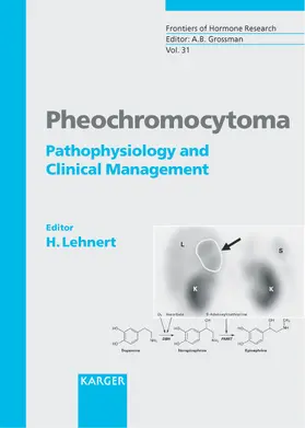 Pheochromocytoma