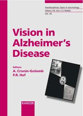 Vision in Alzheimer's Disease