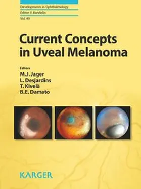 Current Concepts in Uveal Melanoma