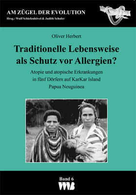 Traditionelle Lebensweise als Schutz vor Allergien?