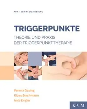 Triggerpunkte