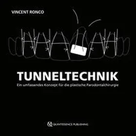 Tunneltechnik