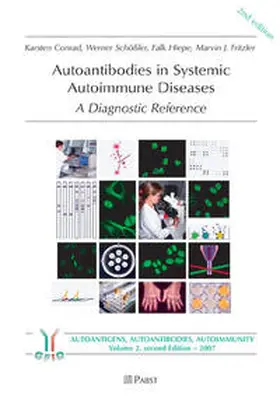Autoantibodies in Systemic Autoimmune Diseases