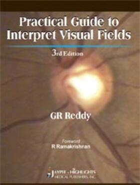 Practical Guide to Interpret Visual Fields