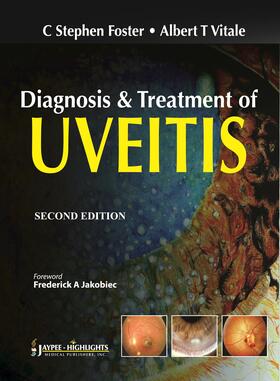 Diagnosis and Treatment of Uveitis