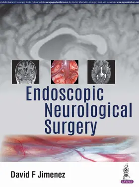 Endoscopic Neurological Surgery