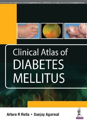 Clinical Atlas of Diabetes Mellitus