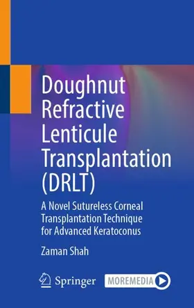 Doughnut Refractive Lenticule Transplantation (DRLT)